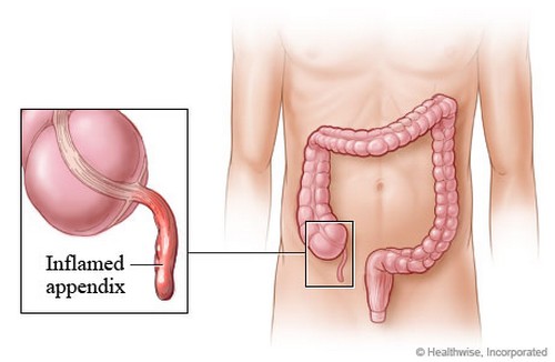 Appendix-Conditions
