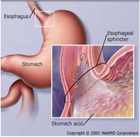 a96773_a489_stomach2.jpg