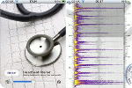 istethoscope